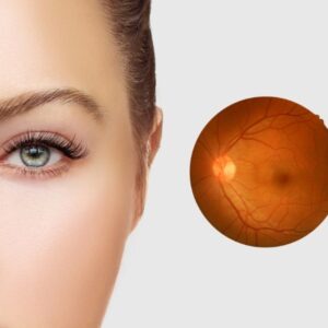 retina-damar-tikanikligi retina-damar-tikanikligi